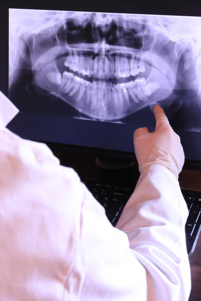 Best Broken or Chipped Tooth Repair in Huron, CA